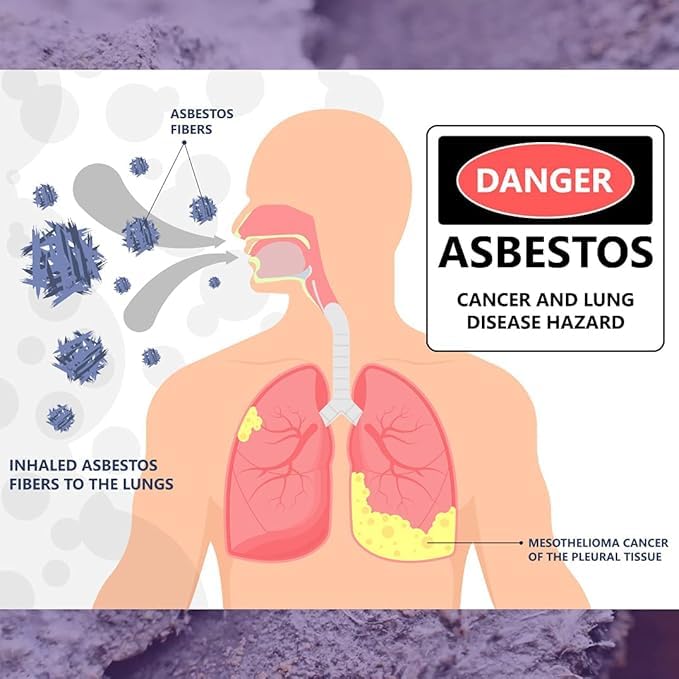 PRO-LAB Asbestos Test Kit - You Collect The Sample (1 pk), We Analyze It. Emailed Results Within 1 Week (5 Business Days) Includes Return Mailer and Expert Consultation. Lab Fee Included