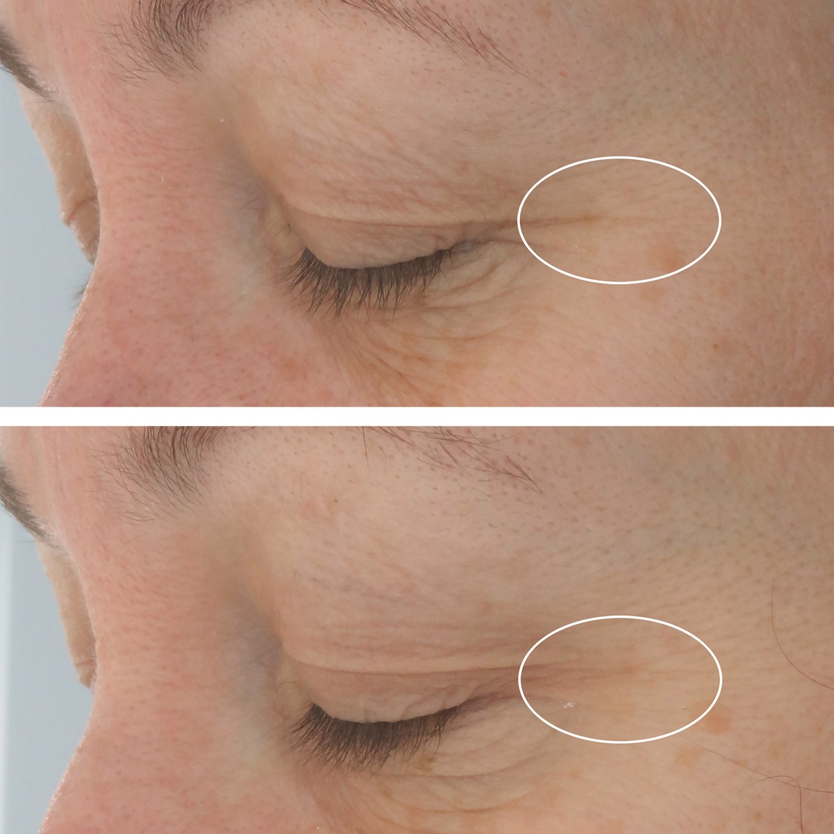 StriVectin Hyaluronic Tripeptide Gel-Cream For Eyes, 0.5 oz & 0.17 oz pack