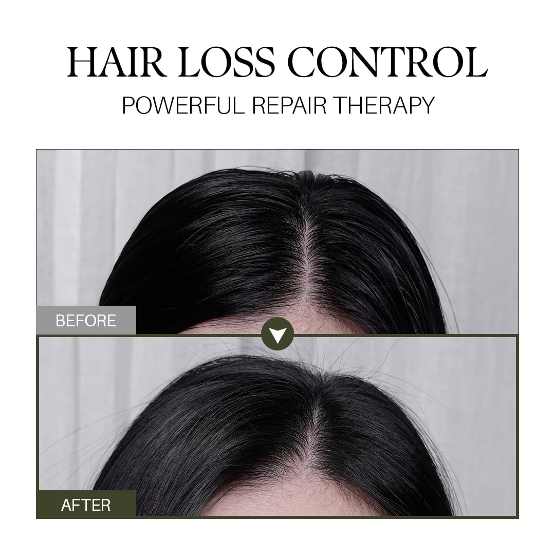 d'alba Piedmont Professional Repairing Scalp Therapy Serum Shampoo 275ml, Mild and Vegan Formula, Gentle Hair and Scap Treatment